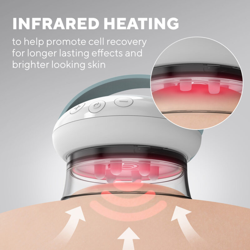 Máy massage trị liệu da làm tan mỡ công nghệ nóng lạnh HoMedics CELL-600-EU 5 Smoothee sử dụng công nghệ hút chân không để hút da vào cốc đồng thời massage mô sâu.
